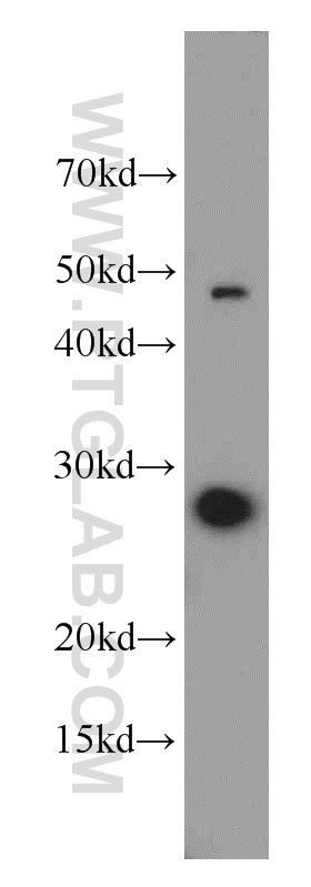 15081-1-AP;MCF7 cell