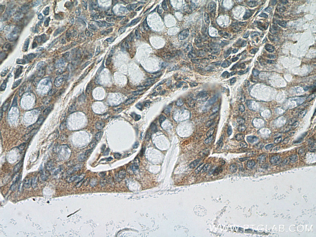 12918-1-AP;mouse colon tissue