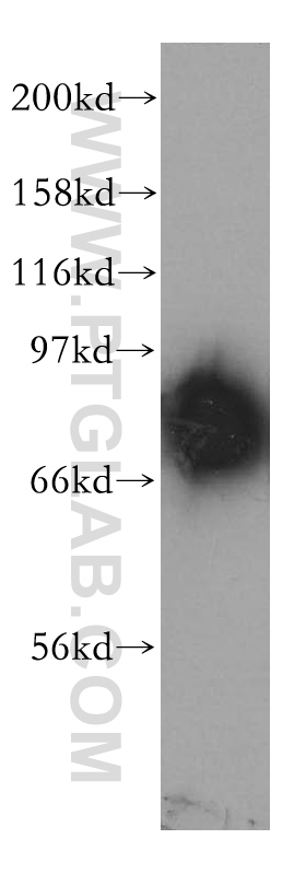 12918-1-AP;mouse brain tissue