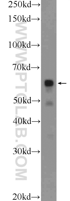 24842-1-AP;MCF-7 cells