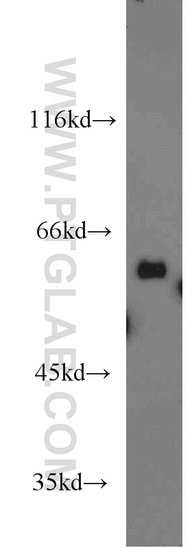 15545-1-AP;mouse liver tissue