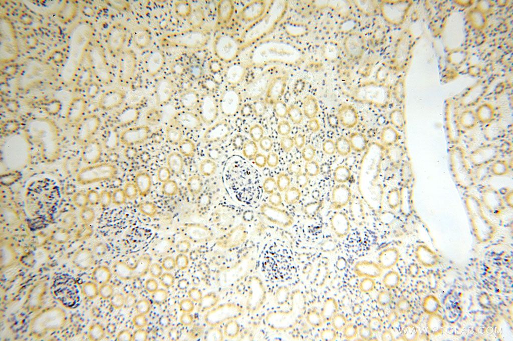 16968-1-AP;human kidney