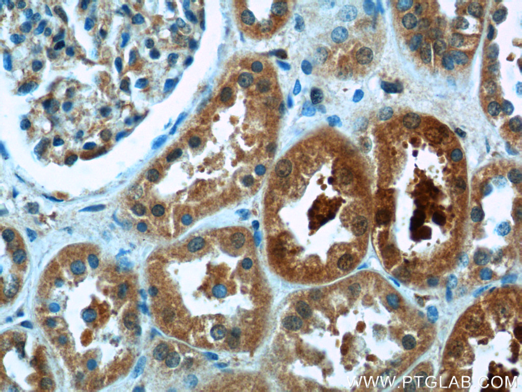 25539-1-AP;human kidney tissue