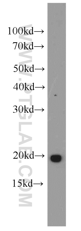 19566-1-AP;human brain tissue