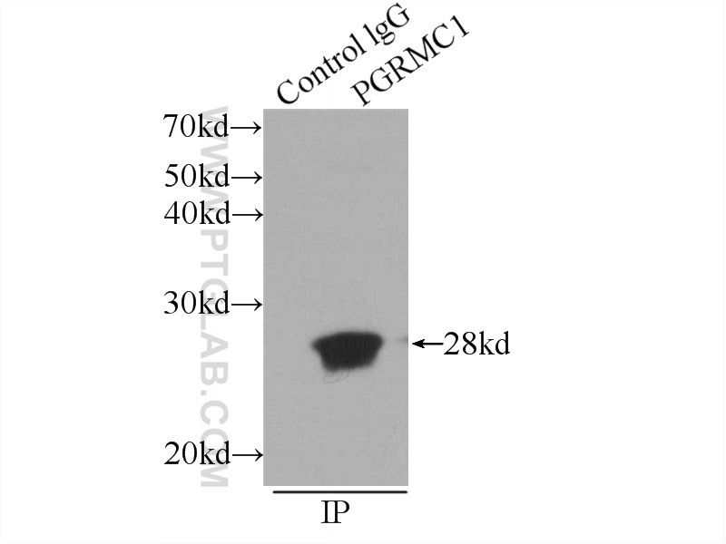 12990-1-AP;MCF-7 cells