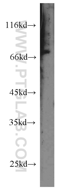 13408-1-AP;mouse eye tissue