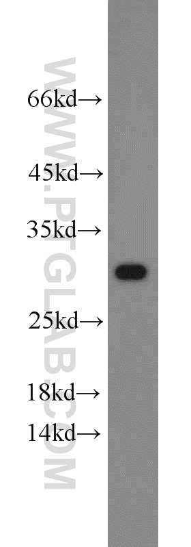 10787-1-AP;HeLa cells