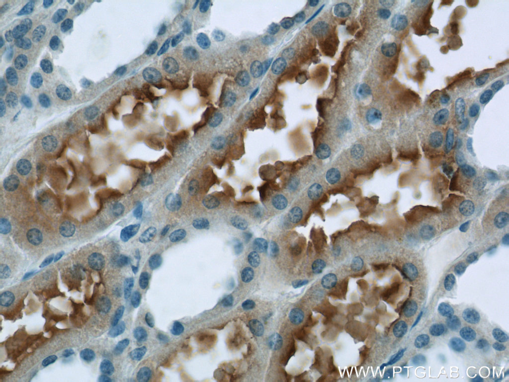 24787-1-AP;human kidney tissue