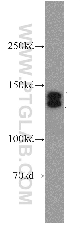 24279-1-AP;mouse skeletal muscle tissue