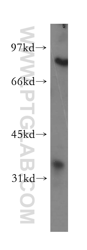 12858-1-AP;human liver tissue