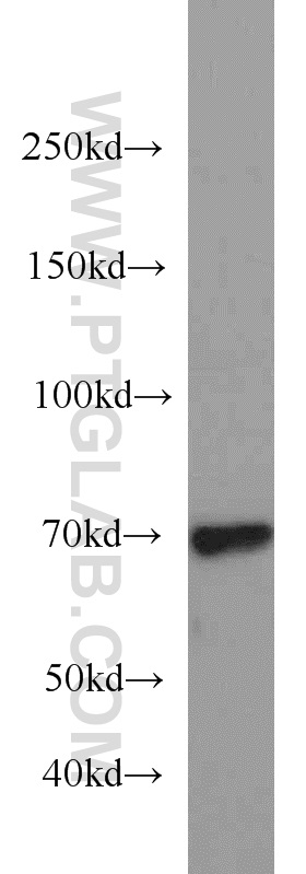 23395-1-AP;Jurkat cells