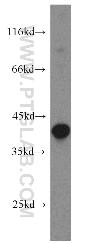 19427-1-AP;HeLa cells