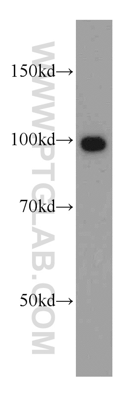 12452-1-AP;PC-3 cells