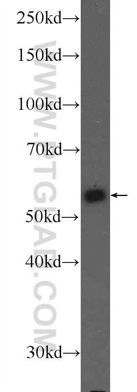 25659-1-AP;HeLa cells