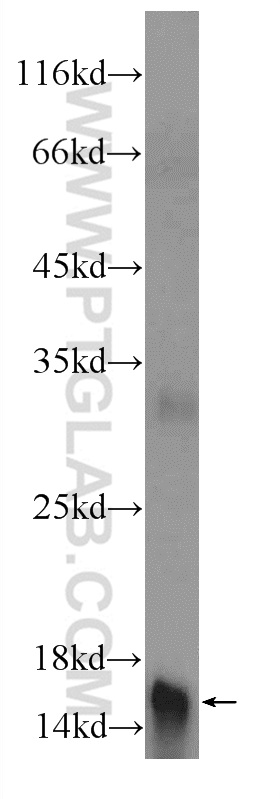 17343-1-AP;human placenta tissue