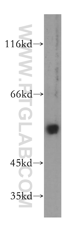 17968-1-AP;HeLa cells