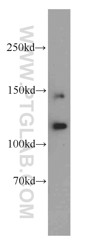 19830-1-AP;mouse heart tissue