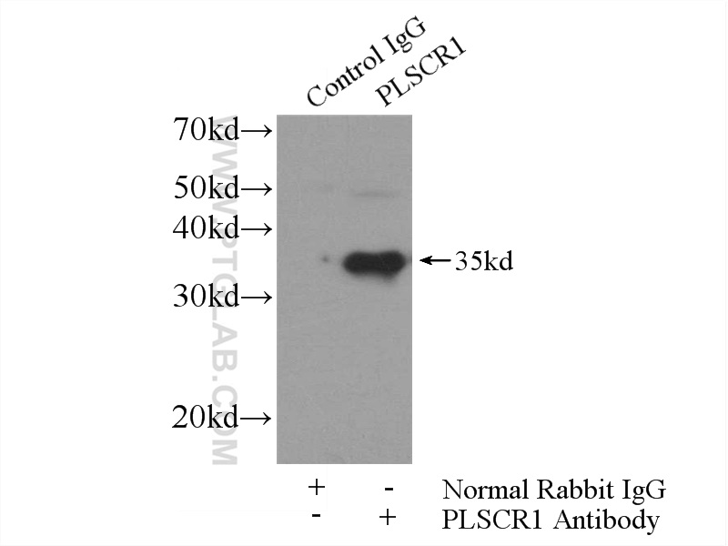 11582-1-AP;mouse lung tissue