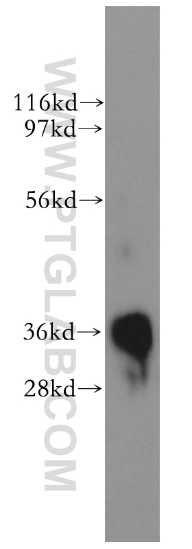 11582-1-AP;human skeletal muscle tissue