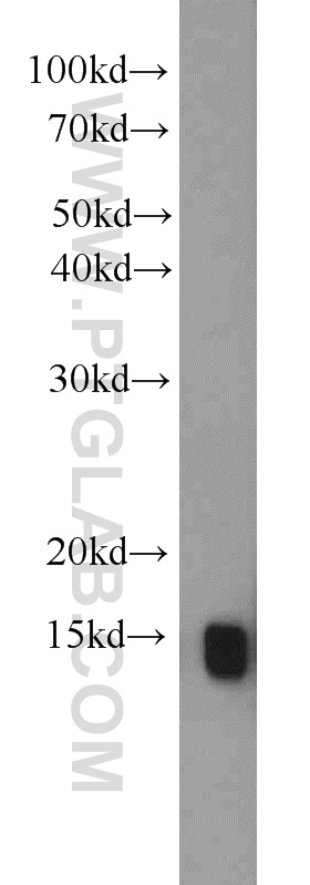 PMP2 Antibody 12717-1-AP | Proteintech