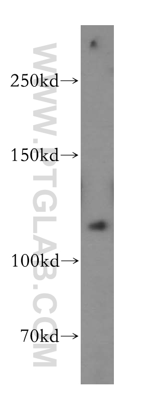 18164-1-AP;A431 cell