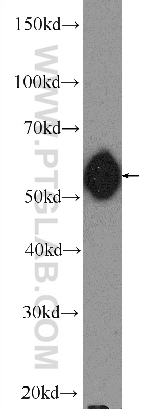 13558-1-AP;Jurkat cells