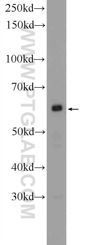 25559-1-AP;Raji cells