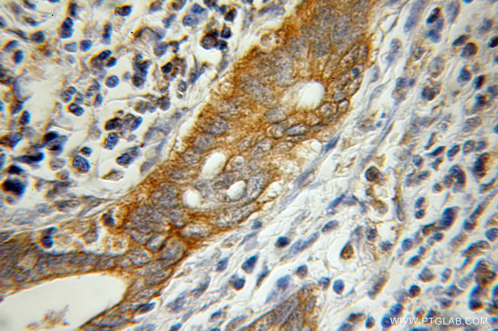 pancreatic lipase antibody 11209-1-ap pview