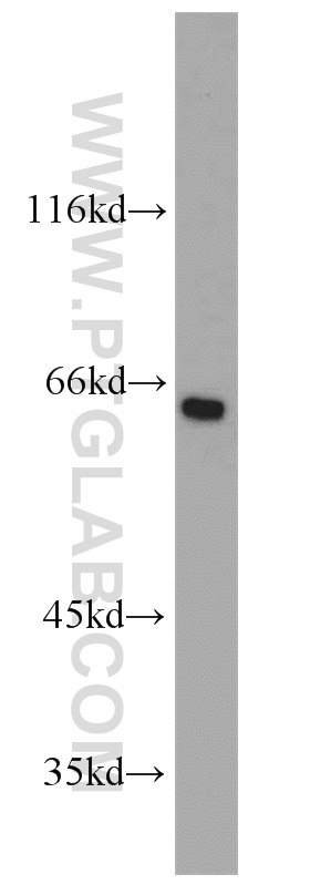 18150-1-AP;HEK-293 cells