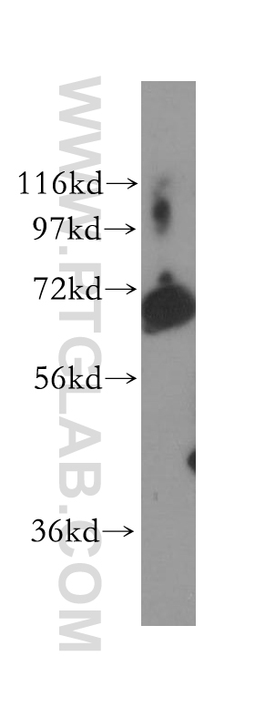 11398-1-AP;human bladder tissue