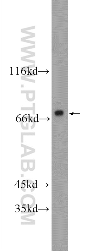 21935-1-AP;MCF-7 cells