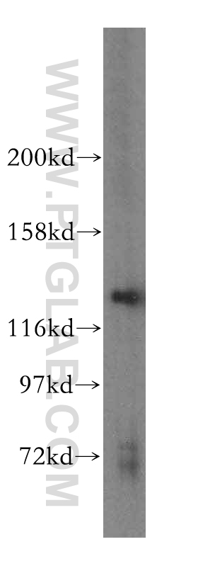 16574-1-AP;HepG2 cell