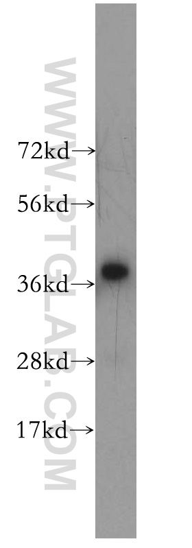 10321-1-AP;HEK-293 cell