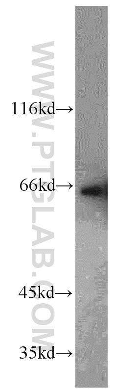 12538-1-AP;HeLa cells