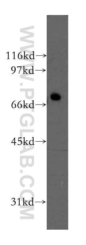 12621-1-AP;A2780 cell