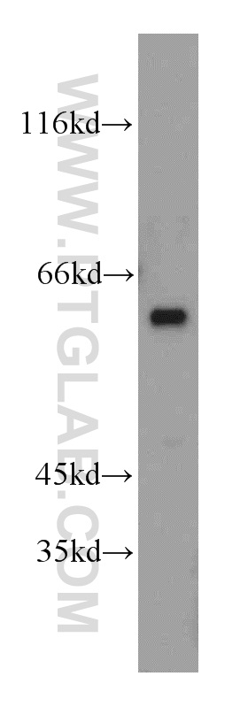 19653-1-AP;mouse testis tissue