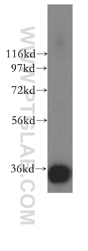 15852-1-AP;human testis tissue