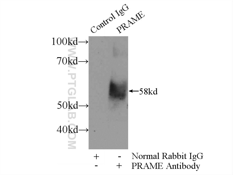 11438-1-AP;A549 cells