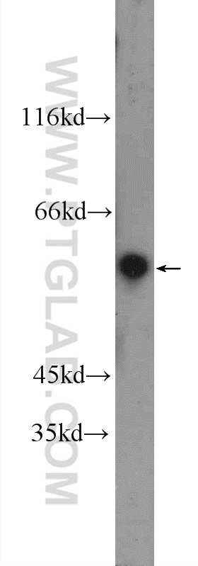 11438-1-AP;A549 cells