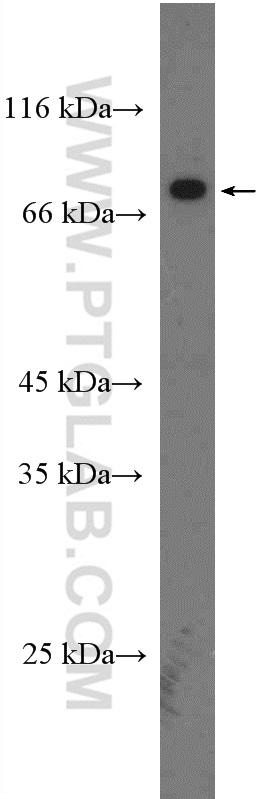 14126-1-AP;mouse ovary tissue