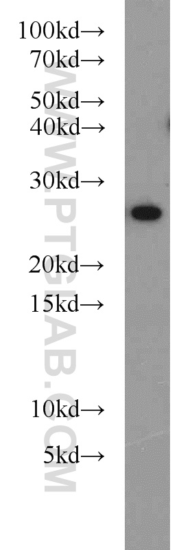 55087-1-AP;MCF7 cells