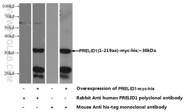 10877-1-AP;Transfected HEK-293 cells