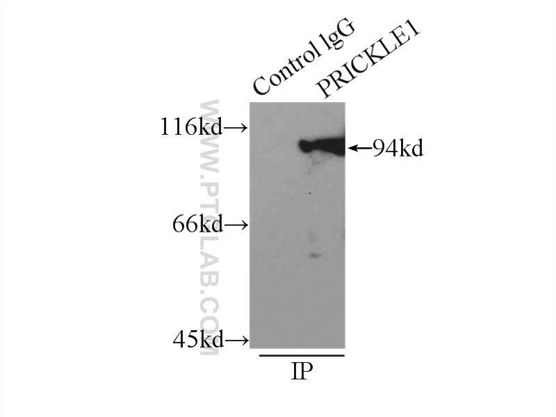 22589-1-AP;mouse brain tissue