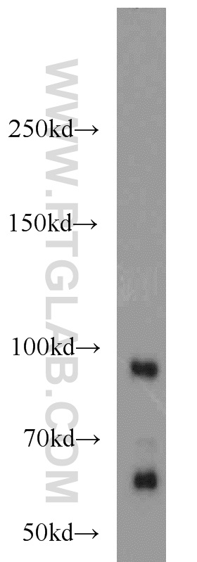 22589-1-AP;mouse brain tissue