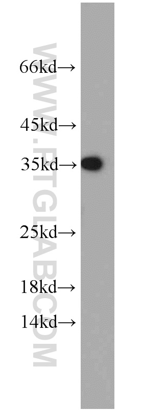 55382-1-AP;mouse brain tissue