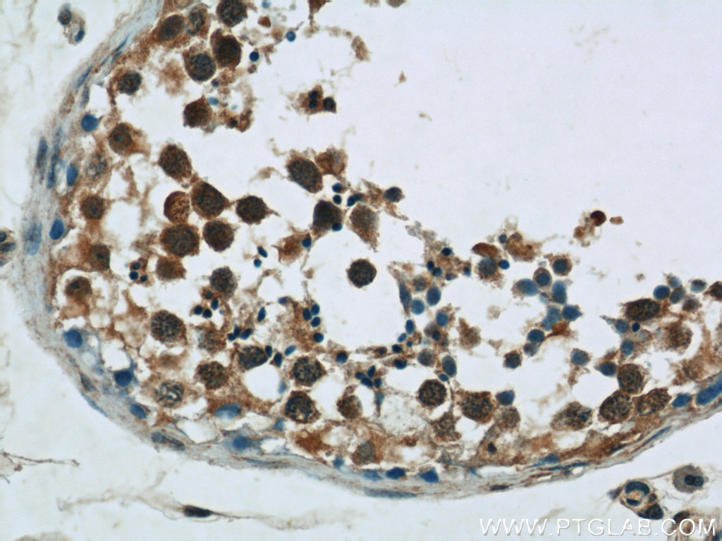 10290-1-AP;human testis tissue