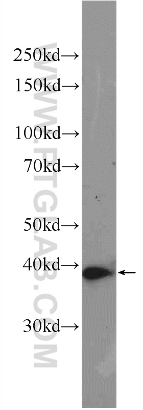 10290-1-AP;K-562 cells