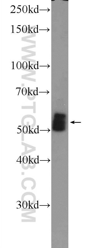 12568-1-AP;mouse heart tissue