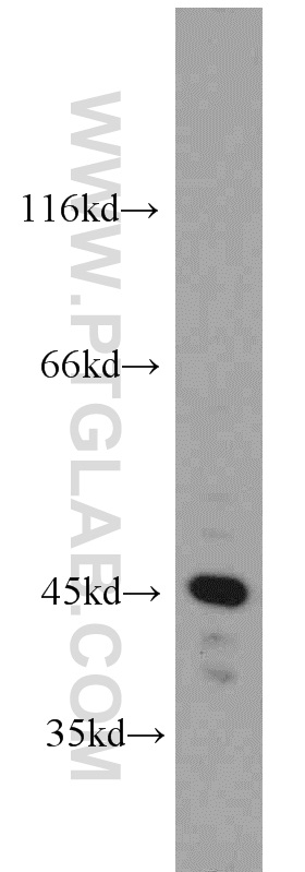 20358-1-AP;HeLa cell