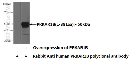 17991-1-AP;Transfected HEK-293 cells